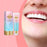 Niacinamide Whitening Toothpaste Dental Stains Removing Prevent Bad Breath Oral Cleaning Refreshing Reduces Plaque Toothpaste