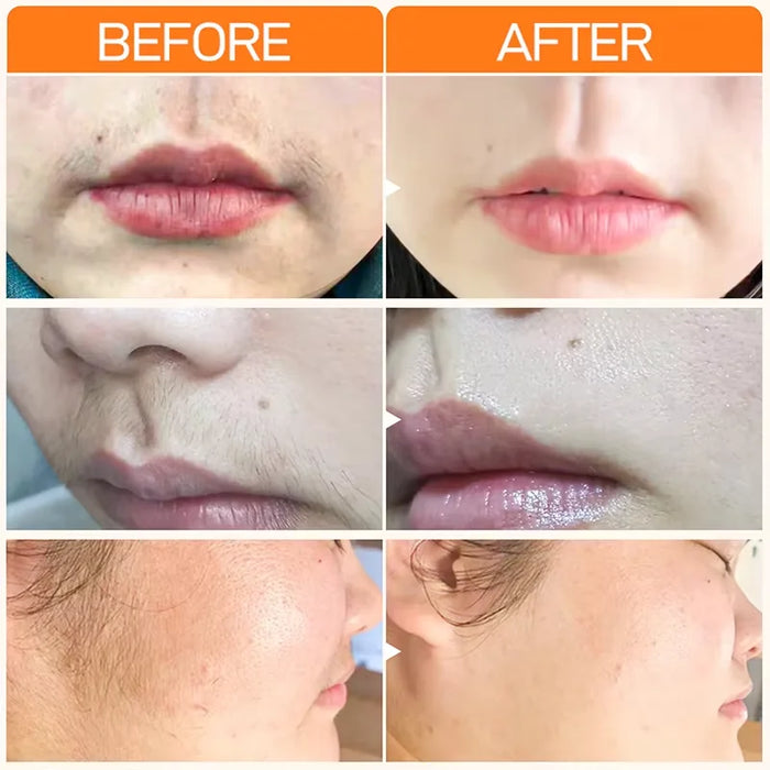 3 Minutes Fast Hair Removal Cream Painless Hair Growth Inhibitor Lip Face Arm Armpit Leg Permanent Depilatory for Men Women Care