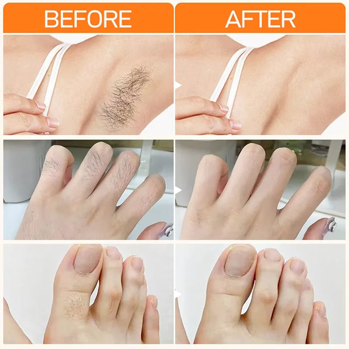 3 Minutes Fast Hair Removal Cream Painless Hair Growth Inhibitor Lip Face Arm Armpit Leg Permanent Depilatory for Men Women Care