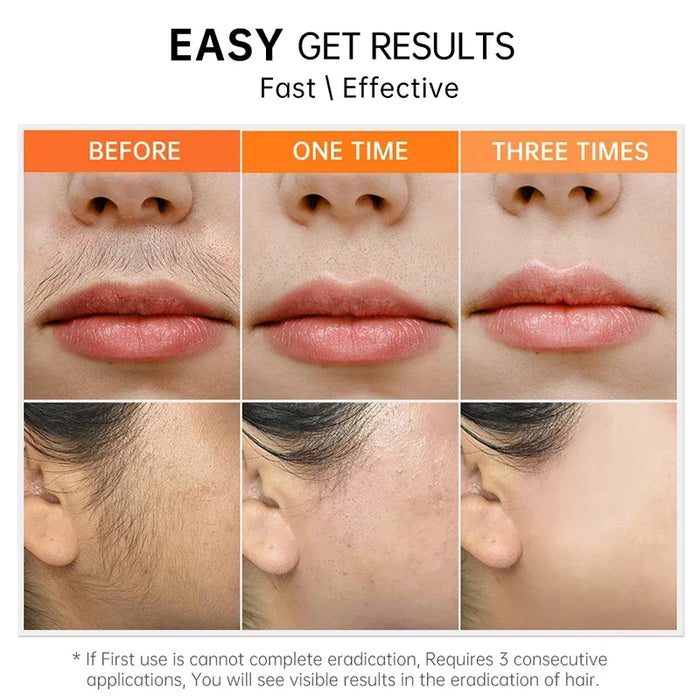 3 Minutes Fast Hair Removal Cream Painless Hair Growth Inhibitor Lip Face Arm Armpit Leg Permanent Depilatory for Men Women Care